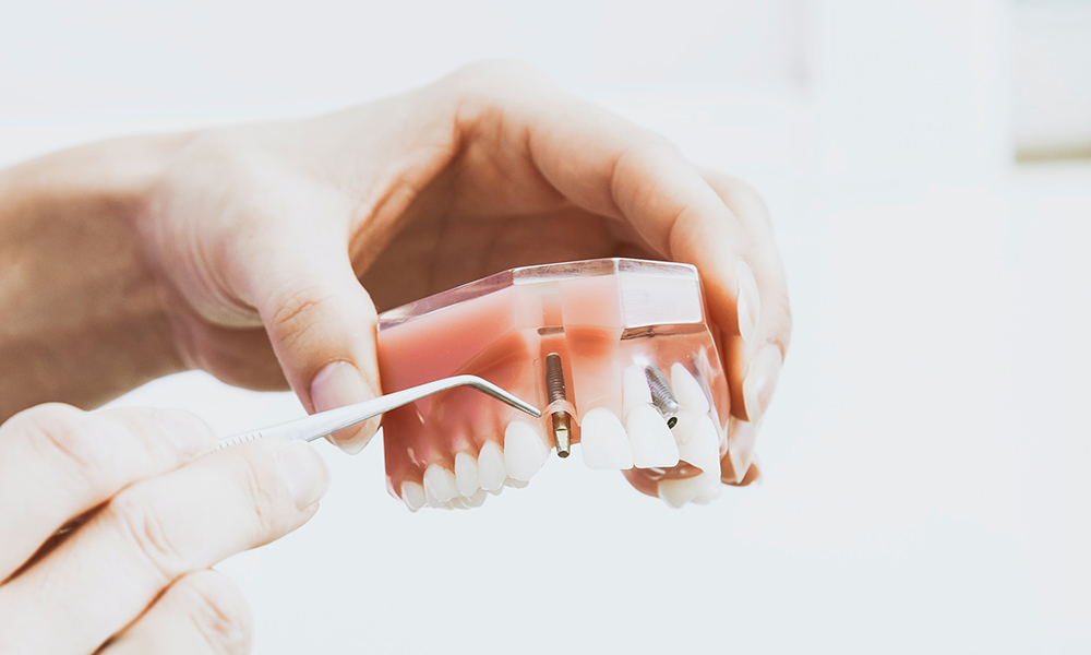 Restorative Dentistry Kanata Kanata Highlands Dental Care